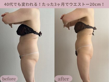 ティターニア(Titania)の写真