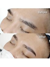 マツ(MATSU)/【ハリウッドブロウリフト】