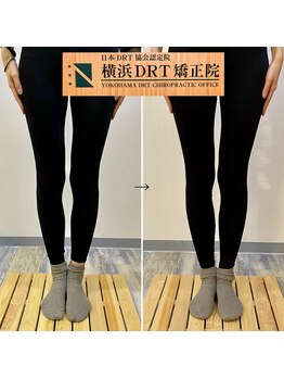 横浜DRT矯正院/美脚矯正