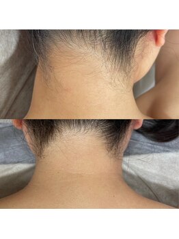 エン(enn)/【うなじ】