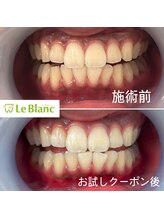 ルブラン 奈良店(Le Blanc)/学生さんも大歓迎！