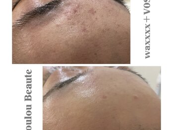 ルルボーテ(Loulou Beaute)/waxxxx+VOSサロンケア