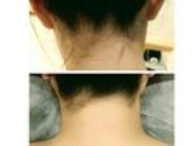 エタニティ 西宮店(Eternity)の雰囲気（うなじ・背中ケアブライダルやイベントに♪）