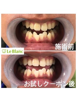 ルブラン 奈良店(Le Blanc)/お口元を見られるご職業のお客様