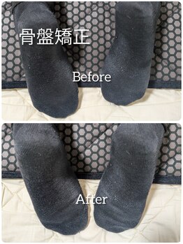 ヨサパーク アエル(YOSA PARK AELL)/小顔/美肌/ヘッド/矯正/整体