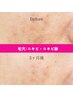 限定！毛穴洗浄・吸引【桁違いの透明感！小顔効果も】毛穴の開き/詰まり解決
