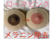 インフィニティ 名古屋金山(INFINITY)/話題のローマピンク