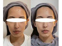 マザートウキョウ(Mother TOKYO)の雰囲気(中顔面短縮/新宿/新宿三丁目/エイジングケア/美白ケア/毛穴)