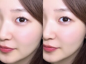 ルピア 緑井(LUPIA)の写真/お子様同伴OK!完全個室のプライベート空間で忙しいママも周りを気にせずリラックスしながら綺麗な目元に♪