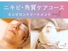 【ニキビ卒業】学生・産後の繰り返す肌荒れをプロが根本ケア◆滑らか美肌へ
