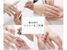 ココモ(cocomo)/(深爪/長さだし/フィルイン) 