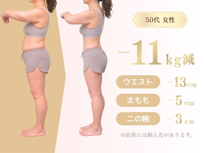 ルティナ(LUTINA)の写真