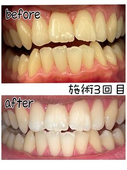 サロンドプラス(Salon de Plus)/Aコースのお客様♪