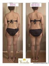 小顔コルギ専門店 フェルーシュ 成田駅前店(Feruche)/姿勢改善背中コルギ(30代女性)