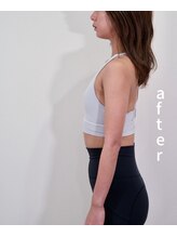 アズール(azure)/美容整体で、姿勢の改善