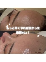 シャイン バンクシア(SHINE Bankusia)/【ダイヤモンドエステ】face wax