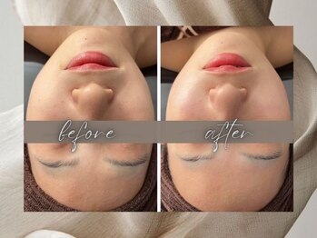 ゴールデンケア(goldencare)/【顔パンパン】がお悩みでした!