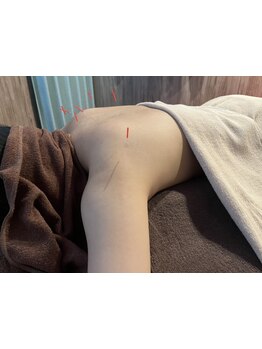 首・肩のつらさを改善したい