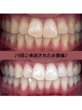 【高濃度水素吸引/オイルトリートメント/ホワイトニング】SUISO PEACE 名古屋丸の内/セルフホワイトニング大好評！