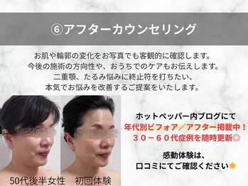 エードットクリニカルサロン 横浜(a.clinicalsalon)/ゴール設定と通い方のご相談