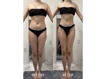 ナルシス/【痩身】モデル体型に★