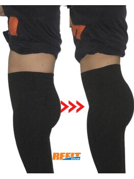 リフィット/猫背・反り腰、ポッコリお腹