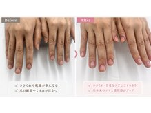 ネイルケアとハンドケアの専門サロン　美爪習慣　池袋店 /自爪育成改善/ハンドエステ//☆劇的ケア☆ビフォー＆アフター