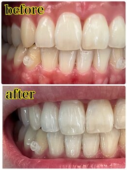 サロンドプラス(Salon de Plus)/Aコースのお客様♪