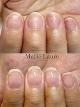 マリーロール 淀屋橋本店(Marie Laure)/自爪育成/深爪矯正/ネイルケア