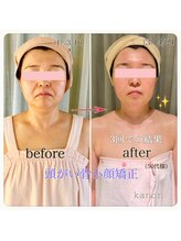 花音/お疲れ顔には頭がい骨から♪