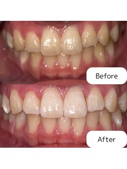 リ ホワイト(Re.White)/