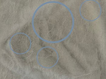 グランボヌール(grand bonheur)/【毛穴の黒ずみ除去】