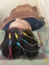 久心宝鍼灸院/とにかく頭鍼