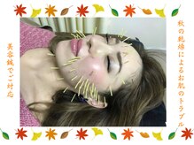 泉町鍼灸整骨院/乾燥によるトラブル美容鍼で対応