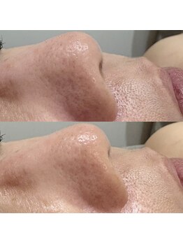 アミュレット(amulette)/エンビロン新トリートメント登場