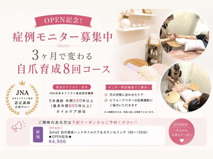 エムアール(MR)の写真