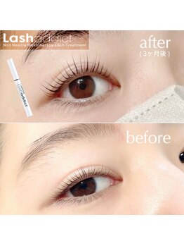 イエン(yien)/LASH LIFT 