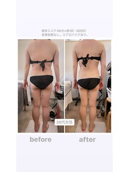 トランキーロ(Tranquilo)/肩凝りがひどい方へ