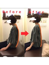 ゆかわ鍼灸整骨院/姿勢矯正