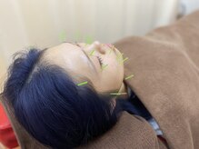 ひめじ鍼灸整骨院の雰囲気（リフトアップ、ターンオーバーの促進を行います。小顔/疲れ目）