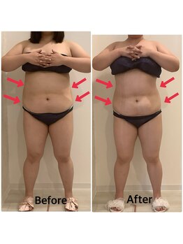 スペチアーレ 夙川/要らない脂肪はトイレに流す