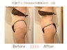 【人気No１】セル脂肪撃退！深部加温で代謝も上げて全身ガッツリ痩身９０分