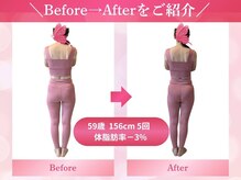 キュートレ 東日本橋 人形町店(Cuetre)/【ビフォアフ4】59歳 5回