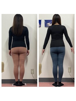 いわき美容整体院/痩身骨盤矯正