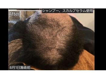 パールブルー(All Perl blue)の写真/男性の髪と頭皮の悩みに！育毛促進、皮脂汚れケアで髪質改善！疲れも癒やすサロン♪