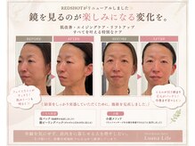 ルアナライフ(Luana Life)