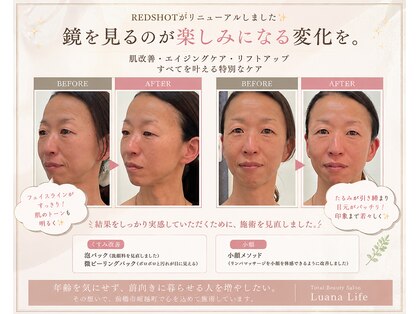 ルアナライフ(Luana Life)の写真