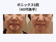 アユアラングレース/40歳後半・1回/むくみ解消