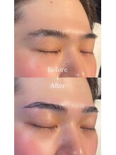眉毛男子 新宿店/Before/After