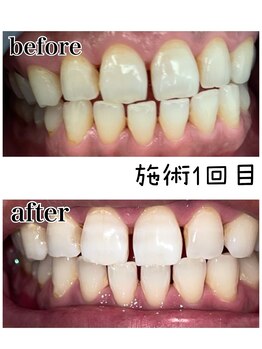 サロンドプラス(Salon de Plus)/